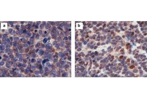 Immunohistochemistry results of Rabbit Anti-hCASZ1 Antibody.