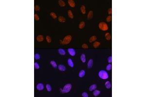 Immunofluorescence analysis of C6 cells using SM/SM/SNF2H Rabbit mAb (ABIN7270656) at dilution of 1:100 (40x lens).