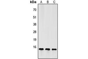 Western blot analysis of FSH beta expression in HeLa (A), Raw264. (FSHB anticorps  (Center))