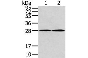 Western Blot analysis of Mouse heart and lung tissue using KCNMB1 Polyclonal Antibody at dilution of 1/500 (KCNMB1 anticorps)