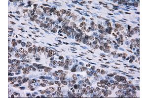 Immunohistochemical staining of paraffin-embedded colon tissue using anti-ID3mouse monoclonal antibody. (ID3 anticorps)