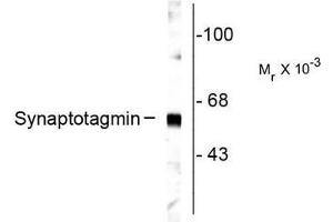 Image no. 1 for anti-Synaptotagmin I (SYT1) antibody (ABIN372723) (SYT1 anticorps)