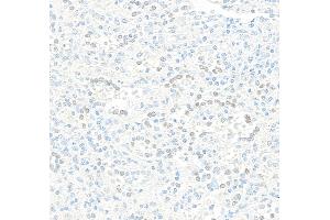 Immunohistochemistry (IHC) image for anti-Jun Dimerization Protein 2 (JDP2) (AA 50-100) antibody (ABIN7795635) (Recombinant JDP2 anticorps  (AA 50-100))