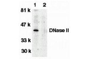 Western Blotting (WB) image for anti-Deoxyribonuclease II, Lysosomal (DNASE2) antibody (ABIN1031743) (DNASE2 anticorps)