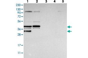 Western blot analysis of Lane 1: RT-4, Lane 2: U-251 MG, Lane 3: Human Plasma, Lane 4: Liver, Lane 5: Tonsil with EBNA1BP2 polyclonal antibody  at 1:250-1:500 dilution. (EBNA1BP2 anticorps)