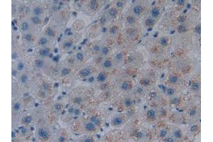 Figure DAB staining on IHC-P Samples: Human Liver Tissue (HMOX1 anticorps  (AA 61-172))