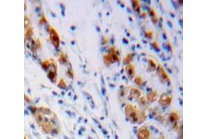 Used in DAB staining on fromalin fixed paraffin-embedded Stomach tissue (LHB anticorps  (AA 23-141))