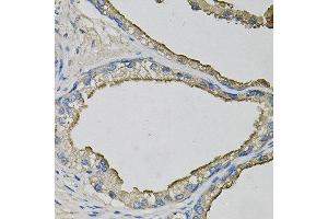 Immunohistochemistry of paraffin-embedded human prostate using LCN1 antibody at dilution of 1:100 (x40 lens). (Lipocalin 1 anticorps)