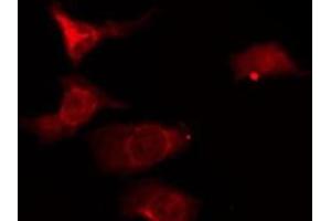 ABIN6276180 staining HeLa by IF/ICC.