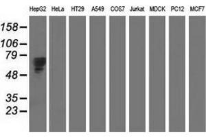 Western blot analysis of extracts (35 µg) from 9 different cell lines by using anti-AFP monoclonal antibody. (alpha Fetoprotein anticorps)