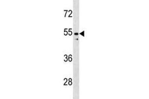 PAX2 antibody western blot analysis in K562 lysate