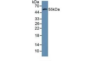 Detection of MMP11 in Human MCF7 Cells using Polyclonal Antibody to Matrix Metalloproteinase 11 (MMP11)
