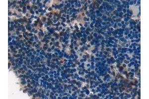 Detection of LAMA1 in Mouse Spleen Tissue using Polyclonal Antibody to Laminin Alpha 1 (LAMA1)