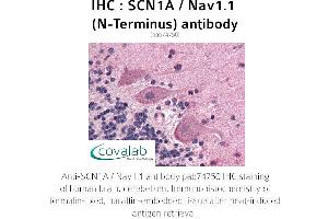 Image no. 1 for anti-Sodium Channel, Voltage-Gated, Type I, alpha Subunit (SCN1A) (N-Term) antibody (ABIN1739058)