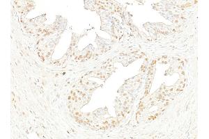 Immunohistochemistry (IHC) image for anti-Bromodomain Containing 4 (BRD4) (AA 1312-1362) antibody (ABIN7453424) (BRD4 anticorps  (AA 1312-1362))
