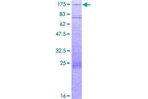 Image no. 1 for HIR Histone Cell Cycle Regulation Defective Homolog A (HIRA) (AA 1-1017) protein (GST tag) (ABIN1306657)