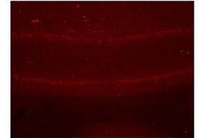 Immunohistochemistry with cerebellum tissue