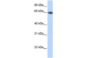 Western Blotting (WB) image for anti-Solute Carrier Family 6 (Neurotransmitter Transporter, Noradrenalin), Member 2 (SLC6A2) antibody (ABIN2458614) (SLC6A2 anticorps)