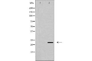 Western blot analysis of CLDN6 expression in Jurkat cells,The lane on the left is treated with the antigen-specific peptide. (Claudin 6 anticorps  (Internal Region))