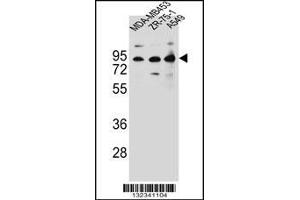 Western blot analysis in MDA-MB453,ZR-75-1,A549 cell line lysates (35ug/lane). (CTTNBP2NL anticorps  (N-Term))