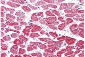 Human Heart: Formalin-Fixed, Paraffin-Embedded (FFPE) (RSPO1 anticorps  (N-Term))