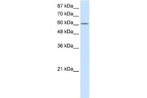 WB Suggested Anti-PRMT5 Antibody Titration:  2. (PRMT5 anticorps  (N-Term))