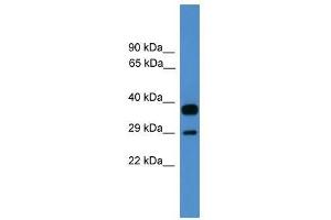 OTUB2 antibody used at 0. (OTUB2 anticorps  (Middle Region))