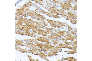 Immunohistochemistry of paraffin-embedded rat heart using KCNJ15 antibody (ABIN7269475) at dilution of 1:100 (40x lens).