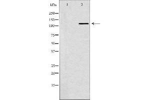 Western blot analysis of Hela whole cell lysates, using SMARCA5 Antibody.