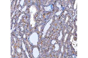 IHC analysis of SLC9A3R2 using anti-SLC9A3R2 antibody (ABIN7599271).