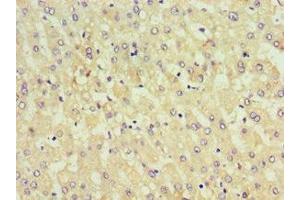 Immunohistochemistry of paraffin-embedded human liver tissue using ABIN7157655 at dilution of 1:100 (KIF6 anticorps  (AA 565-814))