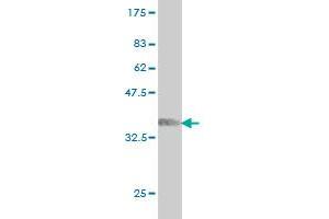 Western Blot detection against Immunogen (36. (ARAF anticorps  (AA 151-250))