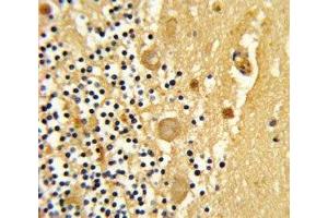 IHC analysis of FFPE human cerebellum stained with GARP antibody