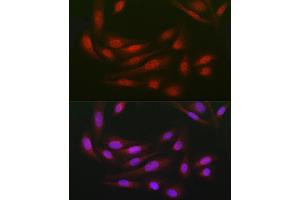 Immunohistochemistry of paraffin-embedded rat stomach using DC Rabbit pAb (ABIN6132184, ABIN6139432, ABIN6139434 and ABIN6222532) at dilution of 1:150 (40x lens).