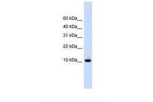 Image no. 1 for anti-D-Dopachrome Tautomerase (DDT) (N-Term) antibody (ABIN6738204) (DDT anticorps  (N-Term))