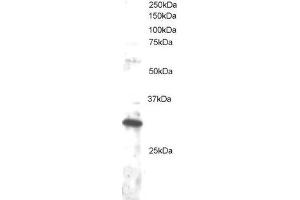 ABIN2562232 staining (1µg/ml) of Jurkat lysate (RIPA buffer, 30µg total protein per lane). (DKK4 anticorps  (C-Term))