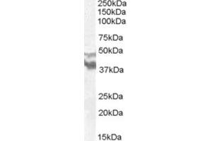 Western Blotting (WB) image for anti-Dyslexia Susceptibility 1 Candidate 1 (DYX1C1) (N-Term) antibody (ABIN2466680) (DYX1C1 anticorps  (N-Term))