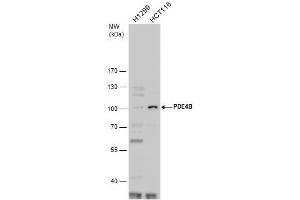 WB Image PDE4B antibody detects PDE4B protein by western blot analysis. (PDE4B anticorps  (C-Term))