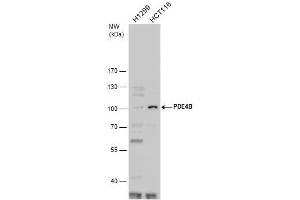WB Image PDE4B antibody detects PDE4B protein by western blot analysis.
