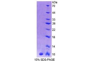 SDS-PAGE analysis of Human CALY Protein. (CALY Protéine)