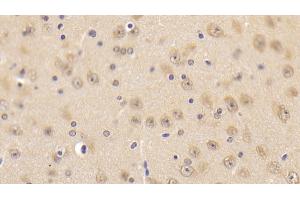 Detection of CAMLG in Mouse Cerebrum Tissue using Polyclonal Antibody to Calcium Modulating Ligand (CAMLG)