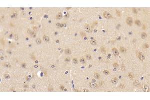 Detection of CAMLG in Mouse Cerebrum Tissue using Polyclonal Antibody to Calcium Modulating Ligand (CAMLG) (CAMLG anticorps  (AA 1-187))