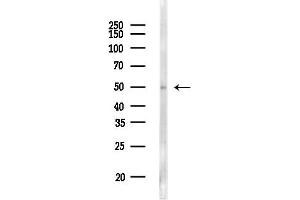 anti-Retinoic Acid Receptor, beta (RARB) (Internal Region) antibody