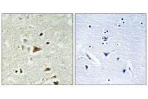 Immunohistochemistry analysis of paraffin-embedded human brain tissue using Smad2 (Ab-220) antiobdy.