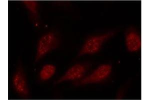 Image no. 2 for anti-Tumor Protein P53 (TP53) (pSer315) antibody (ABIN196788) (p53 anticorps  (pSer315))