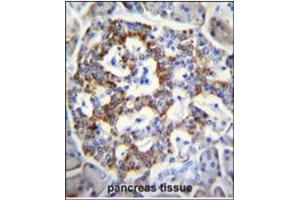 Immunohistochemistry analysis in Formalin Fixed, Paraffin Embedded Human pancreas tissue stained with SEMA3G antibody (Center) followed by peroxidase conjugation of the secondary antibody and DAB staining. (SEMA3G anticorps  (Middle Region))