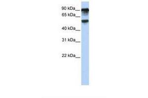 TBC1D10B 抗体  (AA 720-769)