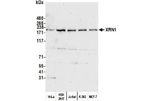 Western Blotting (WB) image for anti-5'-3' Exoribonuclease 1 (XRN1) (C-Term) antibody (ABIN7450913) (XRN1 anticorps  (C-Term))