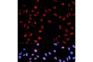 Immunofluorescence analysis of MCF-7 cells using Phospho-AKT(T450) Polyclonal Antibody (AKT1 anticorps  (pThr450))
