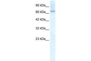 Western Blotting (WB) image for anti-Protein Inhibitor of Activated STAT, 2 (PIAS2) antibody (ABIN2461198) (PIAS2 anticorps)